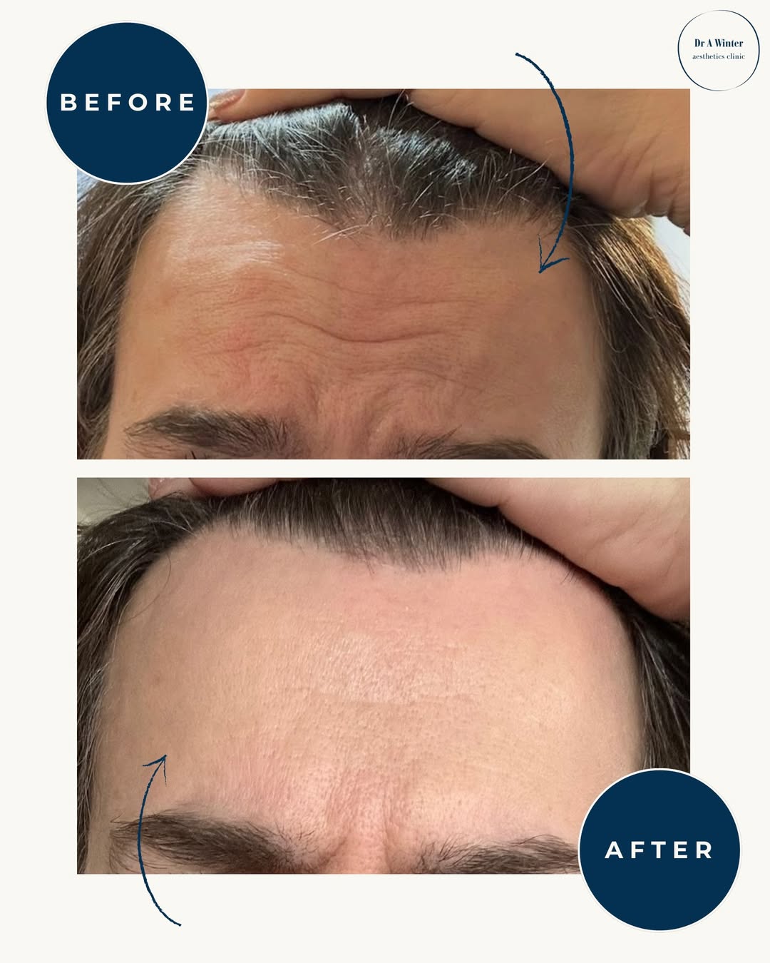 After treatment example