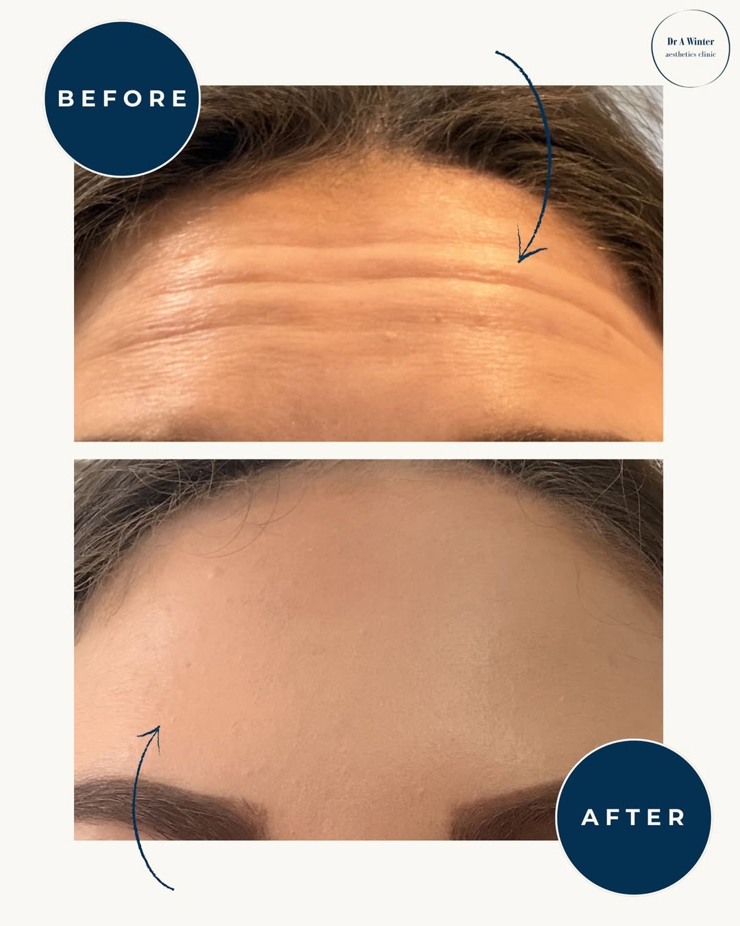 Before and after example from clinic social media